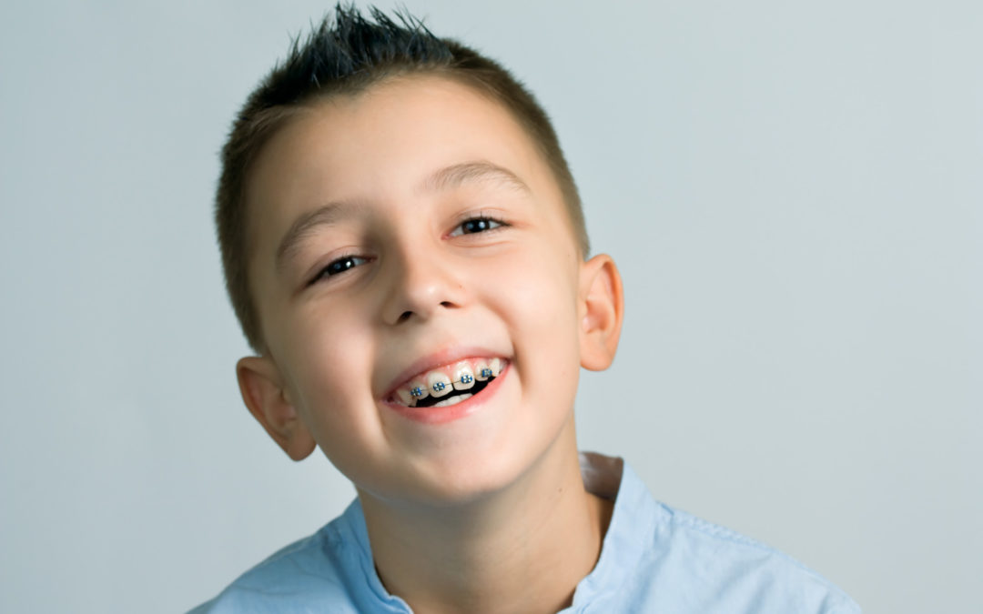 When Should Kids Get Braces?  How to Tell When It’s Time for Braces