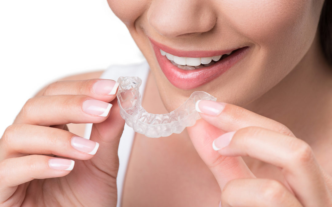 The Smile Solution You’ve Been Looking for: 8 Clear Advantages of Invisalign Aligners
