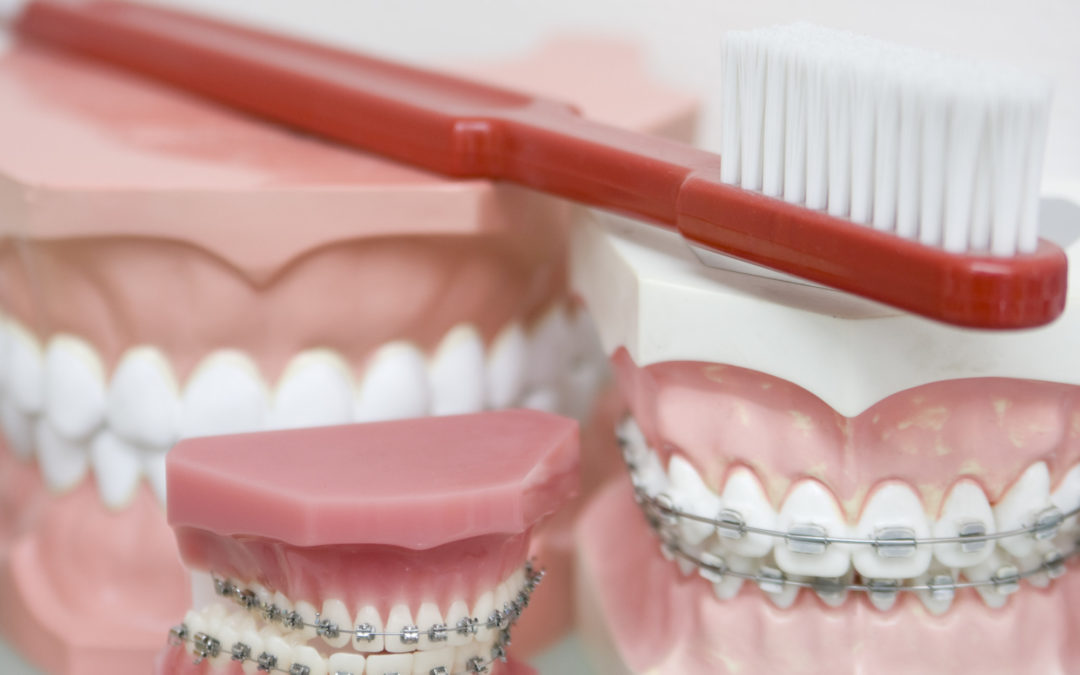 Everything to Consider When Choosing an Orthodontist in Nashville