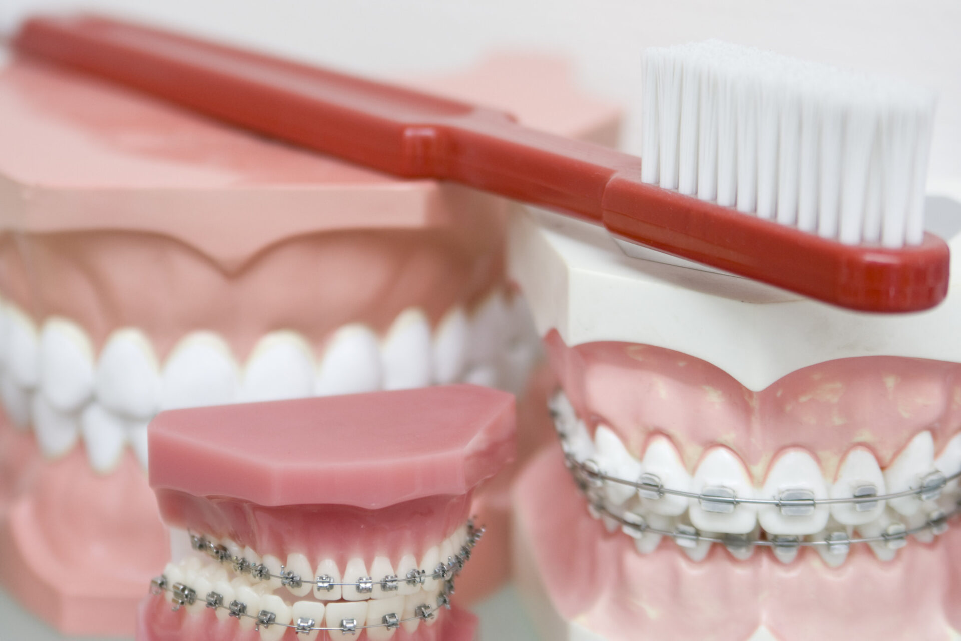 Everything to Consider When Choosing an Orthodontist in Nashville -