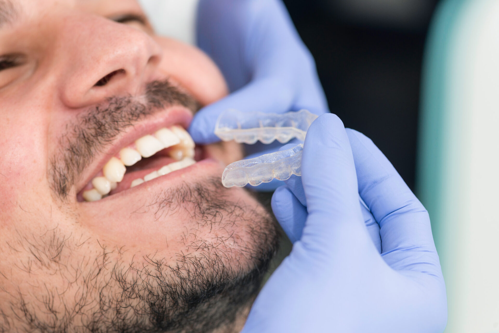 The 5 Most Commonly Asked Questions About Invisalign - Banff Dental Care