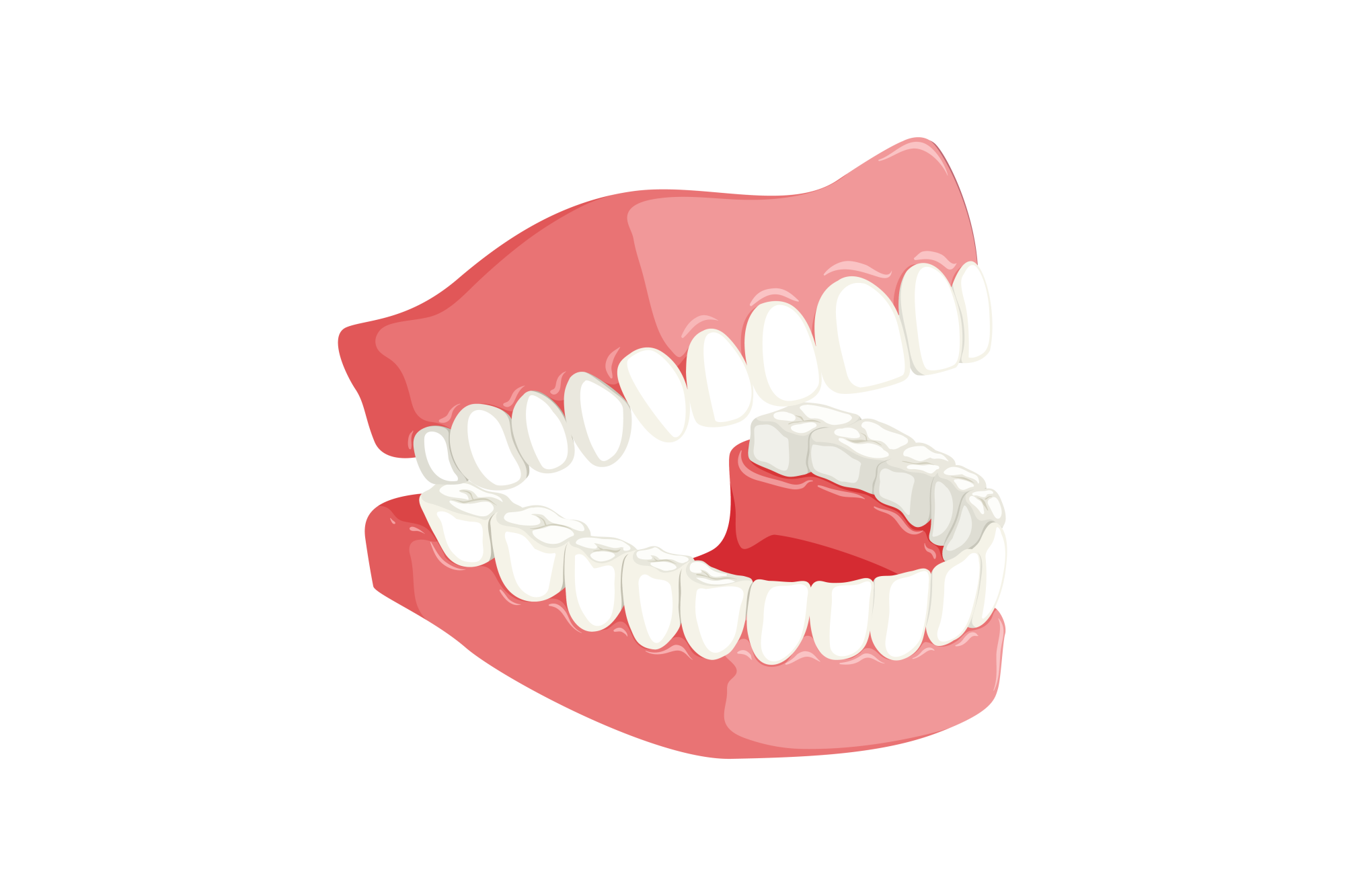 Dental Implants In Garland