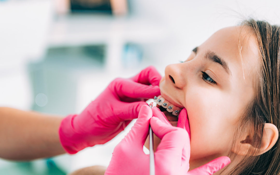 Malocclusion in Children: What Is It and How Can It Be Treated?